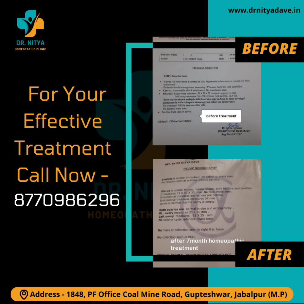 Testimonial-3-1024x1024-1