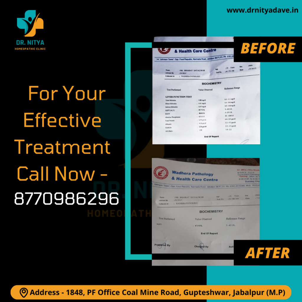 case-of-jaundice-1024x1024-1